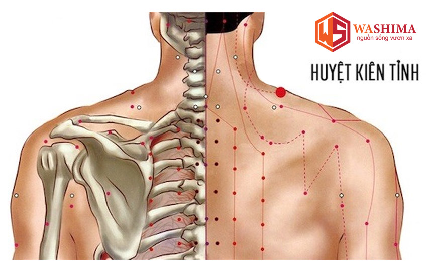 vị trí huyệt Kiên Tỉnh nằm ở trên bả vai
